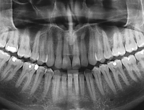 Dental X-Rays: It’s Time For Your Close-Up